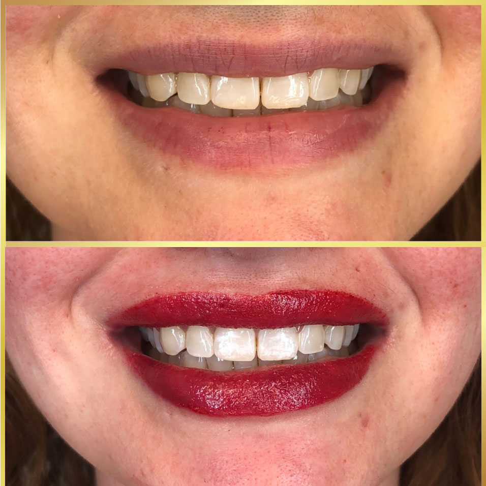 before and after lip tattoo